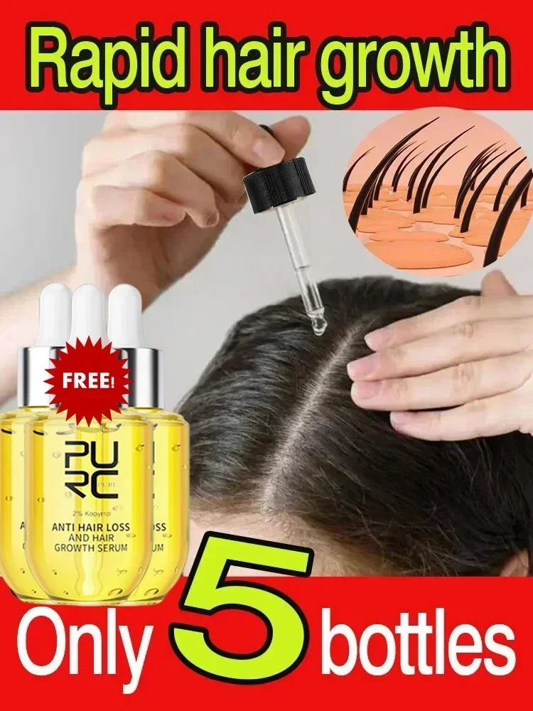 Fast Hair Growth for Men Women Ginger Grow Hair Oil Care Anti Hair Loss Scalp Treatment Serum Products Beauty Health